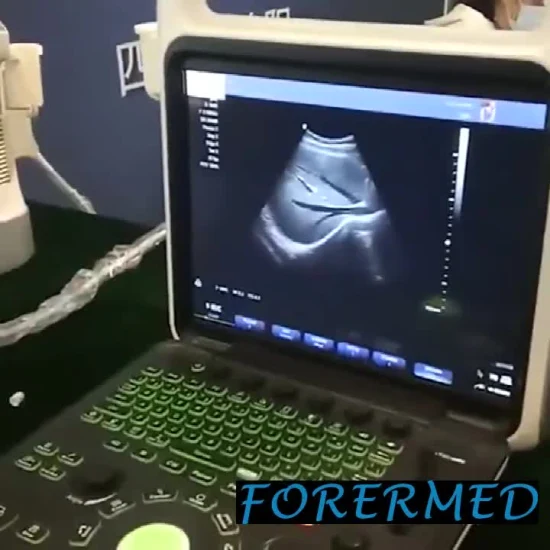 Scanner veterinario veterinario per ultrasuoni fetale portatile per addome e gravidanza