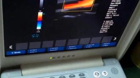 Sistema ad ultrasuoni portatile Sunbright promozionale da 15 pollici con display LCD 2D Color Doppler