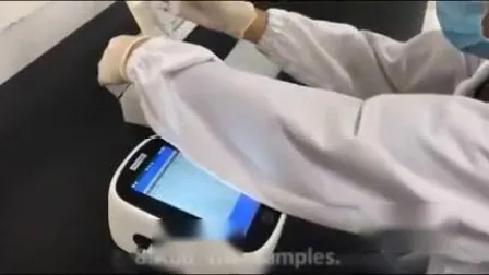 Analizzatore immunologico quantitativo/analizzatore Poct
