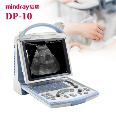 Sistema ad ultrasuoni ecografo portatile Mindray Dp10