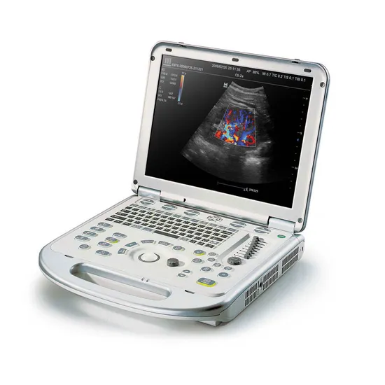 Sistema di imaging diagnostico a ultrasuoni portatile Mindray M7 Premium Sistema a ultrasuoni Color Doppler